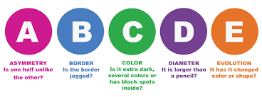 Learn how the abcdes of melanoma were created. Abcde Of Moles Envestpro