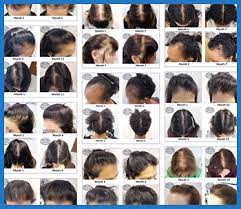 So, if you have fine hair already or notice your hair has been thinning as of late (it's. Why Lemon Juice Won T Improve Hair Growth