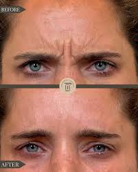 Community Highlights: Meet Sydney Erickson of The Renewal Institute and The  Emerald at La Colombe d'or