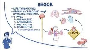 Shock - Neurogenic: Nursing: Video & Causes | Osmosis