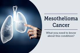 Some cancers grow at a linear rate others exhibit exponential and logarithmic growth rates. What You Need To Know About Mesothelioma By Dr Garima Lybrate