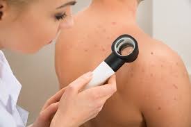 Melanoma can look different from person to person, but these tips can help you determine if you should talk to your doctor about a suspicious spot. More Than Moles When Melanoma Doesn T Look Like You Think It Should The Skin Cancer Foundation