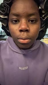 Any tips to get rid of dark spots around mouth?