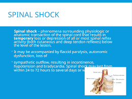 Image result for Spinal Shock