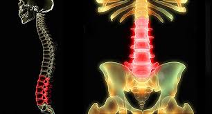 The vertebral column, also known as the backbone or spine, is part of the axial skeleton. Low Back Pain Pictures Symptoms Causes Treatments