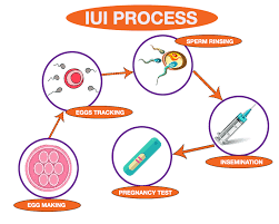 Pin On Iui Preparation