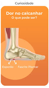 Calçados Para Quem Tem Esporão E Fascite Plantar O Que Pode Ser A Dor No Calcanhar Dor No Calcanhar Cuidados Com Os Pes Faculdade Fisioterapia