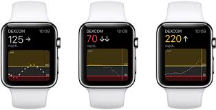Dexcom Mobile Watch Apps