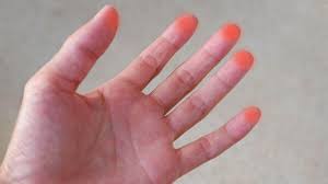 Saat tangan kirinya berada di vaginaku, tangan kanannya mengeluarkan buah dadaku dari dalam bh tanpa membukanya terlebih. 4 Penyebab Ujung Jari Sakit Seperti Ditusuk Jarum Yang Tidak Boleh Diabaikan