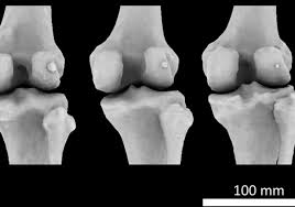 We have 1 possible answer for the clue bones, in anatomy which appears 2 times in our database. Tiny Knee Bone Once Lost In Humans Is Making A Comeback The Scientist Magazine