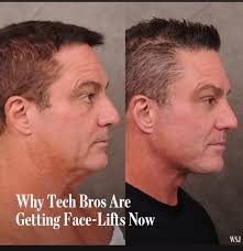 Why Tech Bros Are Getting Face Face-Lifts Lifts Now WSJ
