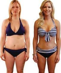 At san diego body contouring, we offer our standard mommy makeover package deal starting at $8,995 to help you get your dream body at an incredible value. Mommy Makeover Cosmetic Surgery Care Michael P Vincent Md Facs