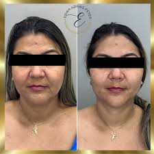 Dra. Erika Arrais Peter