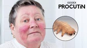 Image result for Demodex brevis