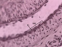 Stratified columnar epithelium is initially present in parts of the gastrointestinal tract in utero, before being replaced with other types of epithelium. Simple Squamous Epithelium 40x Annotated Histology
