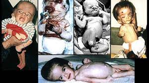 Radiation exposure from depleted uranium: The Doctor The Depleted Uranium And The Dying Children Documentary Heaven