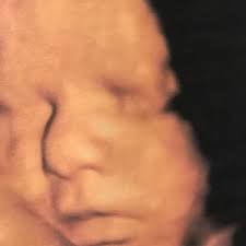 Ist ultraschall in der schwangerschaft gefährlich? 3d 4d Ultraschall