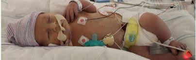 Mason S Story Hypoplastic Left Heart Syndrome The Fetal Center