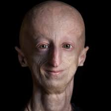 The Progeria Research Foundation