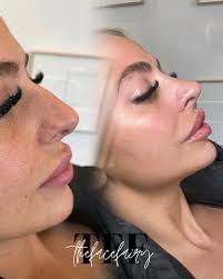 Thefacefairyaesthetics