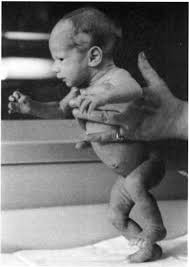 This kettlebell workout will tighten your abs up. Pep Web The Newborn In The Intensive Care Unit A Neuropsychoanalytic Prevention Model