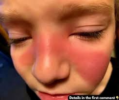 Red flags about hospital visit