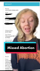 Replying to @sweetrelish_62 Happy Saturday 🤪 #mileyrose #mileyslaw  #pregnancyloss #holoprosencephaly #fetaldemise #ignorantcomments  #abortionrights #abortioncare #abortionisessentialhealthcare ...