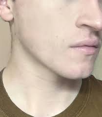 As Seen On TV Skincare' ; Does It Actually Work?