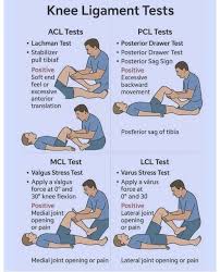 Image result for Lachman Test