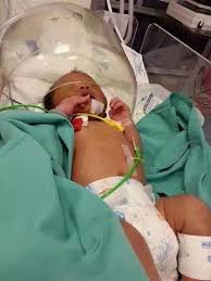 Apa saja obat yang bisa anda gunakan? Kuman Merebak Ke Paru Paru Hampir Masuk Ke Otak Akibat Kesilapan Ibu Uwais Koma 3 Hari Pa Ma