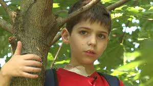 Tony Forte, a multiple-organ transplant recipient from Lancaster County,  dies in Florida hospital