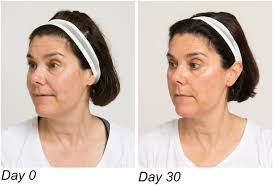 Clinical and Experimental Dermatology: Vol 47, No 12