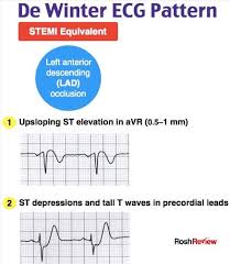 De Winter Ecg Pattern Medical Mnemonics Emergency Medicine Cardiology