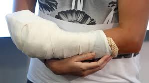Petra kvitova copped another dose of bad luck. Kvitova S Recovery Going Well Reward Offered For Attacker Ctv News
