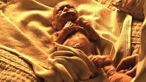 Baby Born As A Old Man Gets Younger As The Years Go On Youtube