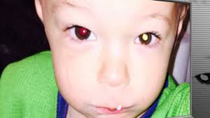 How One Cell Phone Photo Saved This Toddler's Life