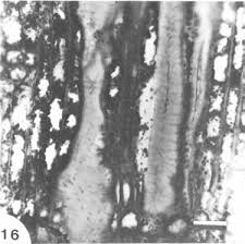 Image result for Allocassine laurifolia