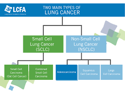 White or pearl lung cancer is by far the leading cause of cancer deaths. Adenocarcinoma Of The Lung An Introduction Lcfa
