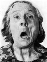 Dystonia in Art: The Impact of Psychiatric and Neurological Disease