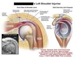 Amicus Injury Shoulder Clavicle Acromion Supraspinatus Glenoid Humerus Deltoid Biceps Tear Anterio Shoulder Surgery Recovery Shoulder Anatomy Shoulder Injuries