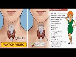Youtube Enlarged Thyroid Memory Problems Healthy Period