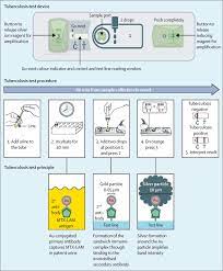 Latent tb infection is diagnosed by detecting specific immunological responses to mycobacterium tuberculosis (mtb) proteins using interferon. Novel Lipoarabinomannan Point Of Care Tuberculosis Test For People With Hiv A Diagnostic Accuracy Study The Lancet Infectious Diseases
