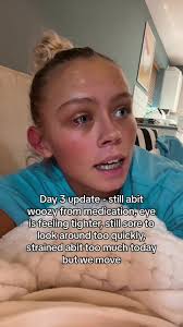 Why Does It Hurt to Look Up with My Eyes