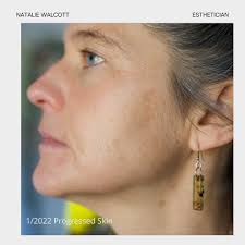 Natalie Walcott Esthetics (@nwalcottskin) • Instagram photos and videos