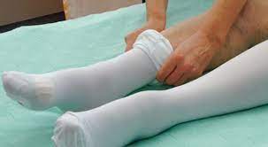 After Surgery Compression Stockings Are Mostly Perscribed By Physicians