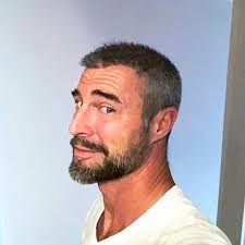 Nel caso dei capelli di matthew mcconaughey, l' . Flavio Montrucchio Ha Fatto Il Trapianto Di Capelli Le Foto Prima E Dopo