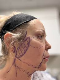 Needle box resembling a minion at the hospital