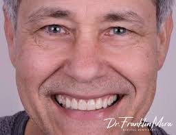 Gracias YEMEL por hacer las citas dentales un espacio para aprender de la  vida, por trasmitir su conocimiento y genuinamente muy amenas. “Don't Need  Your Rocking Chair”