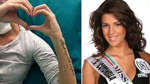 Gessica notaro ospite alla finale di miss italia 2017: Gessica Notaro L Intervento All Occhio E Andato Bene Ora Due Mesi Di Benda