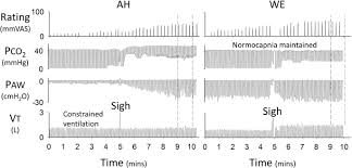 These are the colors i use when making charts in excel 2007. Inhaled Furosemide For Relief Of Air Hunger Versus Sense Of Breathing Effort A Randomized Controlled Trial Respiratory Research Full Text